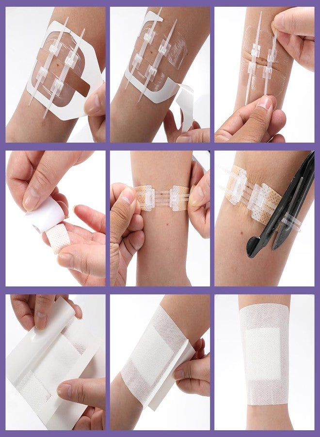 Yeasing Zip Stitch 13 Pack Wound Closure Strip 3 Types Emergency Laceration Closure Kit Butterfly Bandages Adhesive Bandages Without Stitches for Outdoors - Image 3
